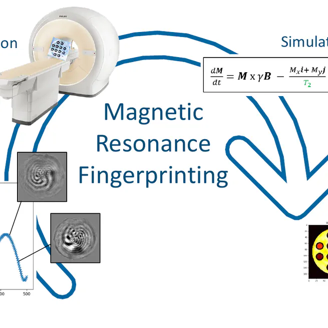 MRI Fingerprinting with Philips